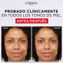 L'Oréal Paris Revitalift Filler Crema de Día Anti-Arrugas 50ml - Mayor Concentración de Ácido Hialurónico